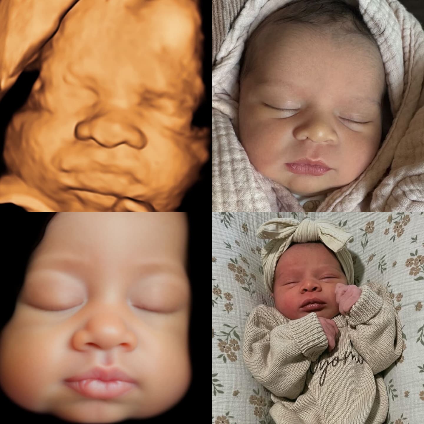 Four-panel comparison: 3D ultrasound, born baby, 8K enhanced portrait, and born baby side by side