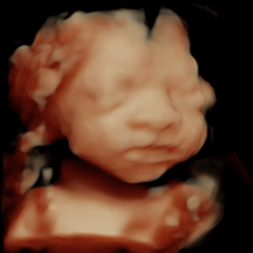 Original 3D ultrasound scan image